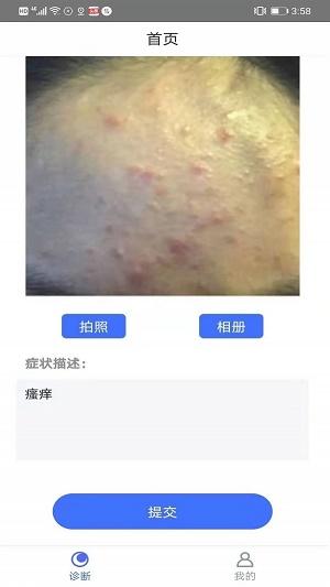 可以拍照识别皮肤病的软件(拍一拍识别皮肤病软件排行榜有哪些哪个好用)