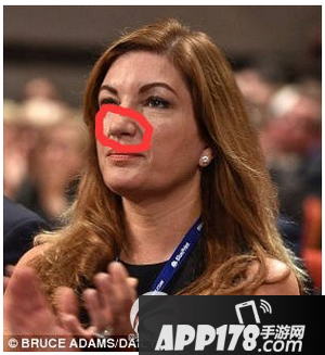 土豪脸长什么样子 男女土豪脸面部特征介绍8