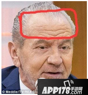 土豪脸长什么样子 男女土豪脸面部特征介绍3